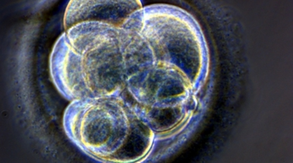 Cloned embryo. ©REUTERS