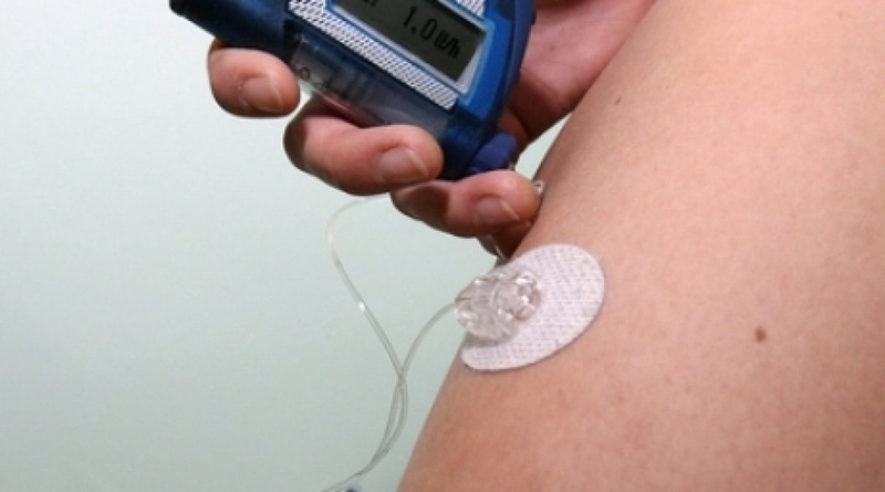 Insulin pump. ©RIA Novosti
