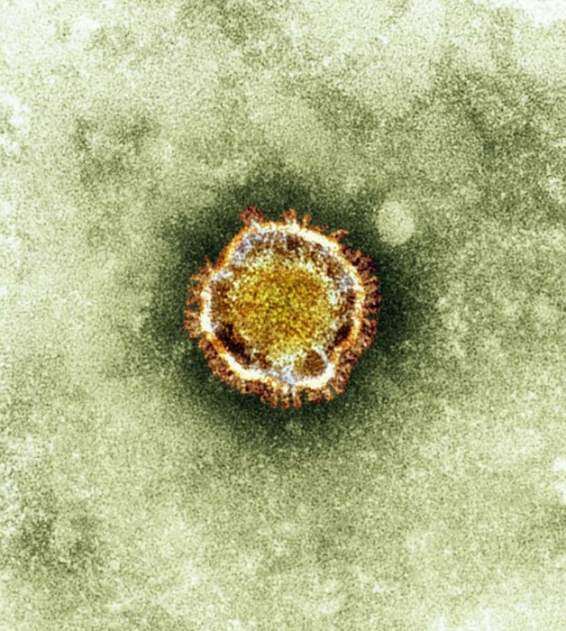 A electron microscope image of a coronavirus. ©REUTER/Health Protection Agency