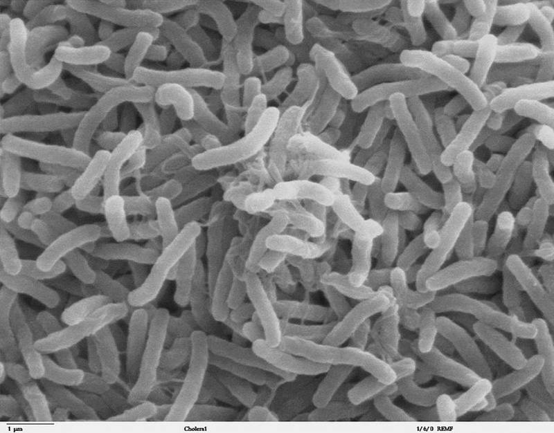 Cholera bacteria SEM. Photo courtesy of wikipedia.org