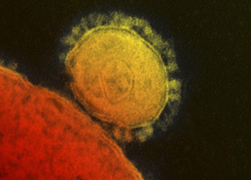 The Middle East respiratory syndrome (MERS). ©Reuters/National Institute for Allergy and Infectious Diseases